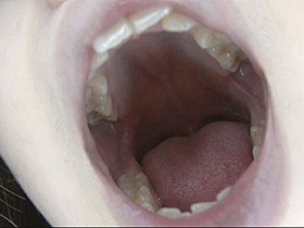 300人のおくち 第2集　サンプル画像08